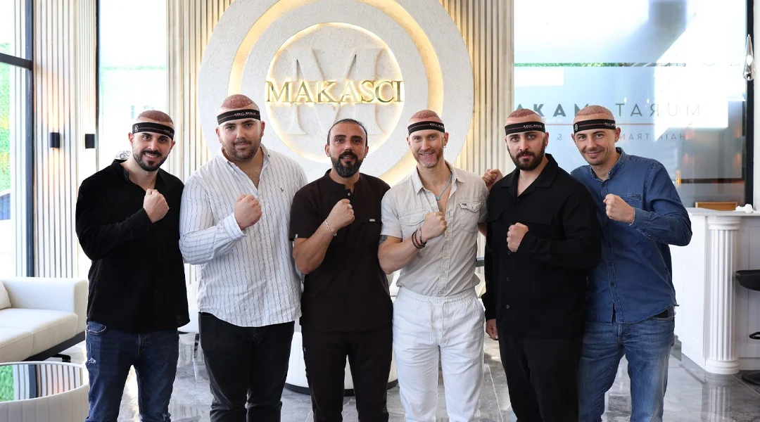Saç Ekimi Kararı Nasıl Verilmeli? Murat Makascı’dan Doğal Sonuç İçin Rehber
