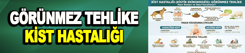 Görünmez Tehlike Kist Hastalığı