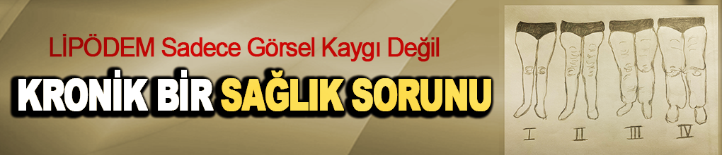 Lipödem sadece görsel kaygı değil kronik bir sağlık sorunu